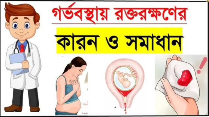 গর্ভধারণে রক্তপাত হলে কী করবেন গর্ভধারণে রক্তপাত হলে কী করবেন