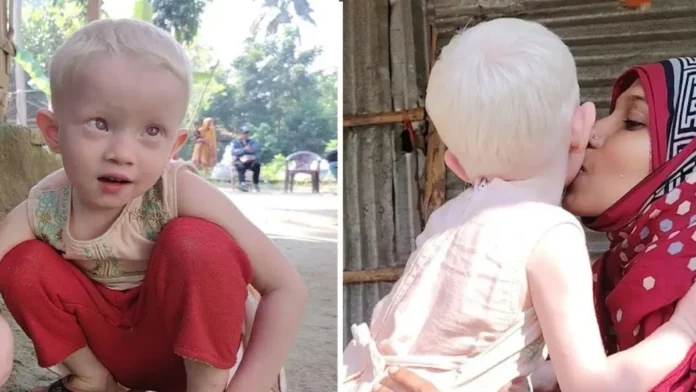 সন্তানের রং নিয়ে ভুল বুঝে ডিভোর্স দিয়েছেন